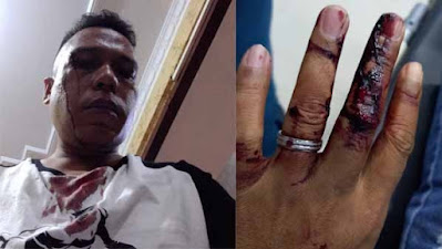 Hanafi Mantan Ketua PWI Kabupaten Lamandau Jadi Korban Penganiayaan 