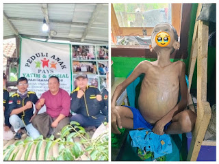 Pamijahan: PAYS Galang Donasi Untuk Anak 12 Tahun Pengidap Penyakit Kanker Perut