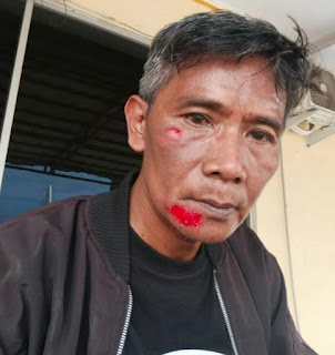 Debt Colektor Lakukan Penganiayaan Kepada Salah Seorang Wartawan di-Tangerang